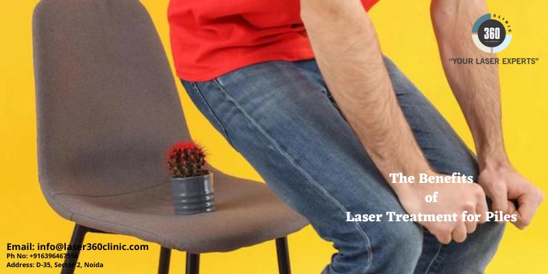 The Benefits of Laser Treatment for Piles